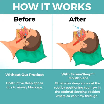 Anti Snore Solution