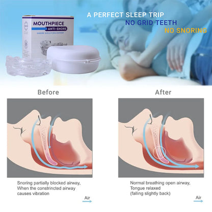 Anti Snore Solution